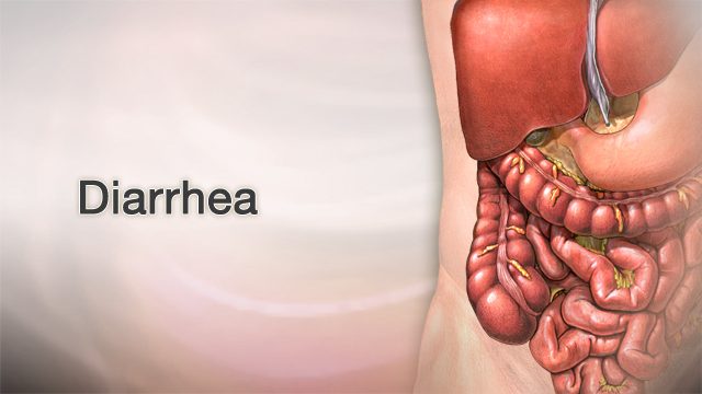 Why Diarrhea Happens: Insights from a Leading Gastroenterologist in Bangalore