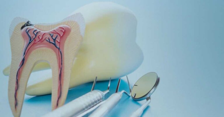 root-canal-treatment