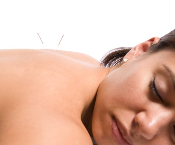 From Stress to Pain Relief – How Acupuncture in Chennai Works!