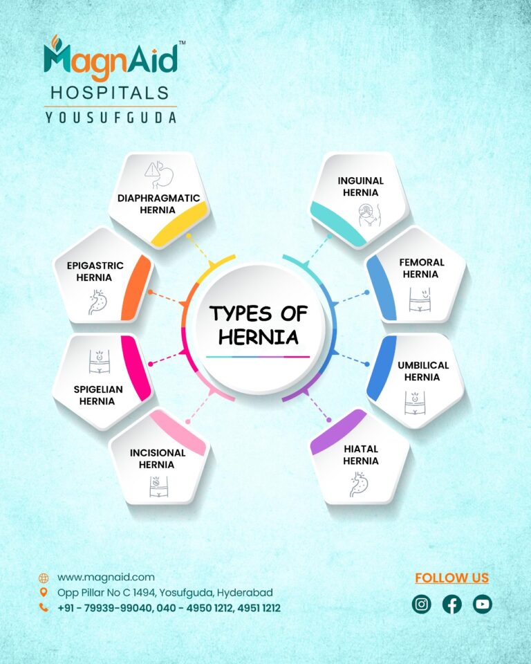 Hernia-treatment-in-Hyderabad
