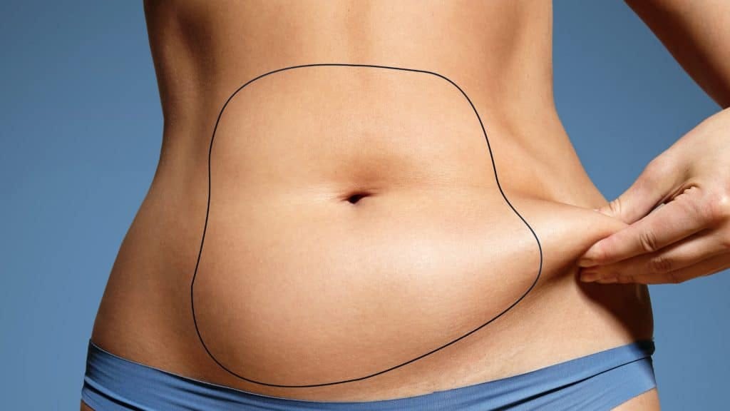 Liposuction Wellness Tips for Healthy Living from Best Doctors in Dubai